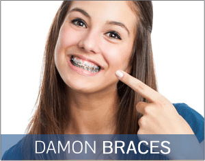 Damon Braces Mountain View Orthodontics Las Vegas NV