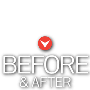 Before & After Mountain View Orthodontics Las Vegas NV